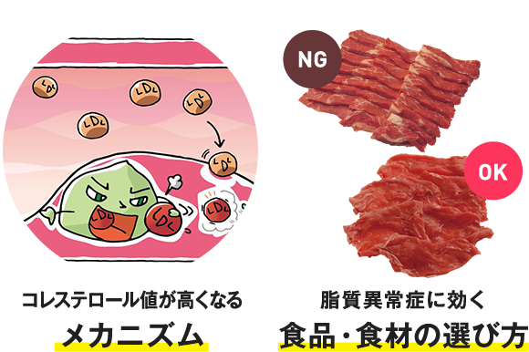 コレステロール値が高くなるメカニズムと脂質異常症に効く食品の選び方の画像です。