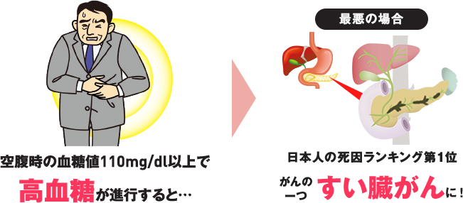 高血糖とすい臓がんに関する画像です。