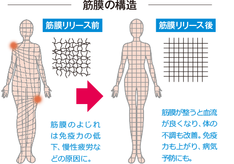 筋膜リリースセラピスト資格講座 自宅で不調を改善できる方法は 通信教育講座 資格のキャリカレ