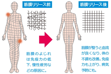 筋膜リリースセラピストの施術を受けている画像